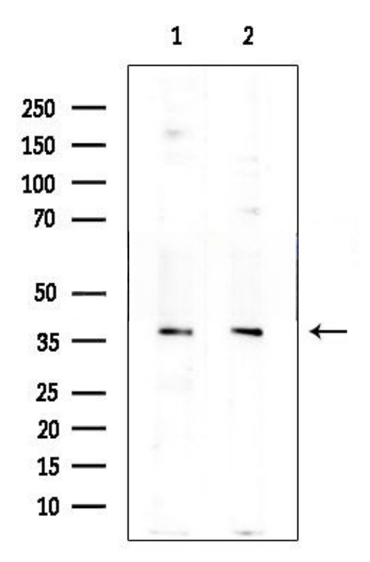 Rabbit Polyclonal Antibody To VSIG4 Omnimabs